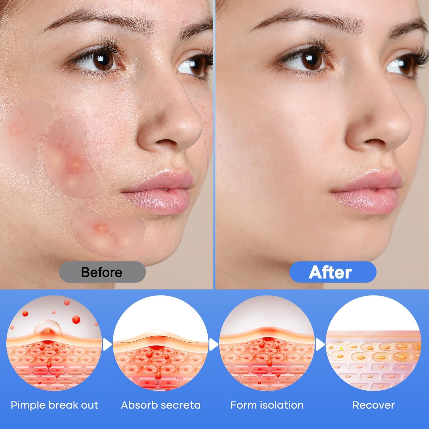 Day and Night Zit Patches