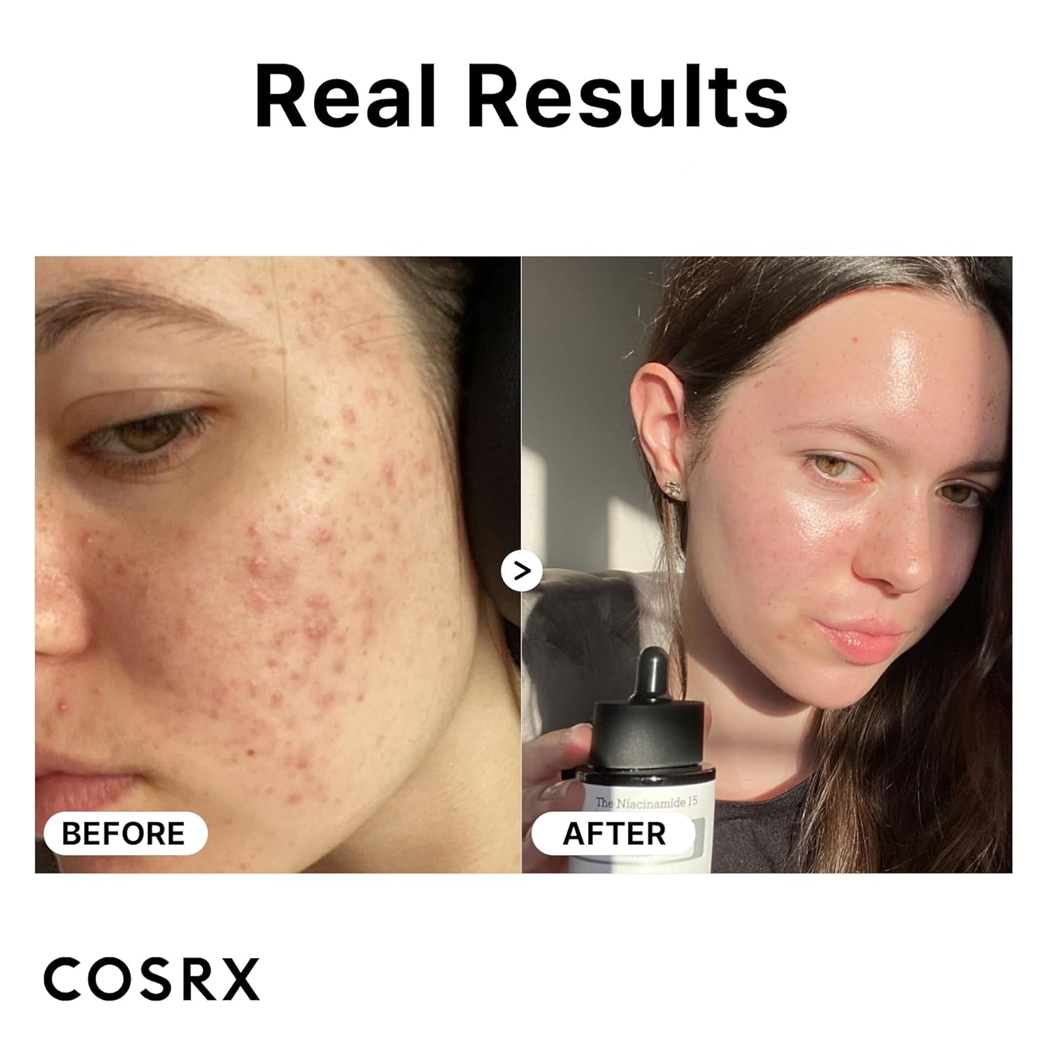 COSRX Niacinamide Serum